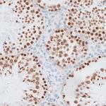 Histone H2A.X Antibody in Immunohistochemistry (Paraffin) (IHC (P))