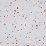 Histone H2A.X Antibody in Immunohistochemistry (Paraffin) (IHC (P))