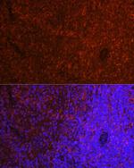 PYCARD Antibody in Immunocytochemistry (ICC/IF)