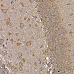 STAT3 Antibody in Immunohistochemistry (Paraffin) (IHC (P))