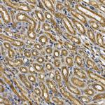 STAT3 Antibody in Immunohistochemistry (Paraffin) (IHC (P))