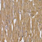 STAT3 Antibody in Immunohistochemistry (Paraffin) (IHC (P))