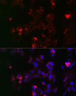 NOX1 Antibody in Immunocytochemistry (ICC/IF)