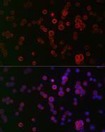 NOX1 Antibody in Immunocytochemistry (ICC/IF)