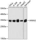 Annexin A3 Antibody in Western Blot (WB)