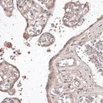 MEF2C Antibody in Immunohistochemistry (Paraffin) (IHC (P))