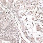 MEF2C Antibody in Immunohistochemistry (Paraffin) (IHC (P))