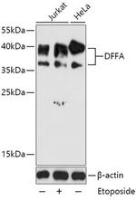 ICAD Antibody in Western Blot (WB)