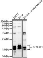 4EBP1 Antibody in Western Blot (WB)