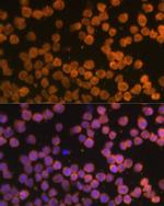 DR4 Antibody in Immunocytochemistry (ICC/IF)