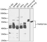 DR4 Antibody in Western Blot (WB)