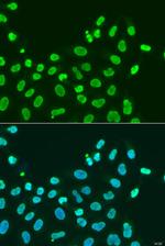 HP1 alpha Antibody in Immunocytochemistry (ICC/IF)