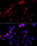 Aromatase Antibody in Immunocytochemistry (ICC/IF)