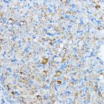 Aromatase Antibody in Immunohistochemistry (Paraffin) (IHC (P))