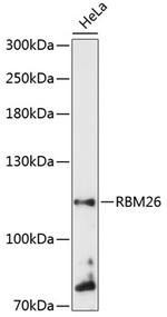 RBM26 Antibody in Western Blot (WB)