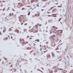 U2AF1 Antibody in Immunohistochemistry (Paraffin) (IHC (P))