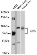 GARS Antibody in Western Blot (WB)