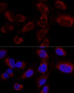 HADHA Antibody in Immunocytochemistry (ICC/IF)