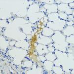 Plasma Kallikrein Antibody in Immunohistochemistry (Paraffin) (IHC (P))