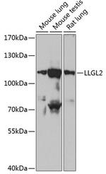 LLGL2 Antibody in Western Blot (WB)