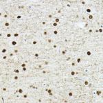 TEF1 Antibody in Immunohistochemistry (Paraffin) (IHC (P))