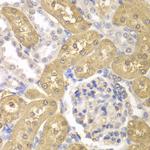 AKR1A1 Antibody in Immunohistochemistry (Paraffin) (IHC (P))