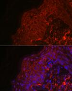 EGF Antibody in Immunohistochemistry (Paraffin) (IHC (P))