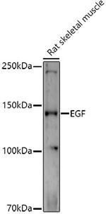 EGF Antibody in Western Blot (WB)