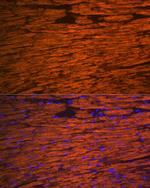 MYL2 Antibody in Immunohistochemistry (Paraffin) (IHC (P))