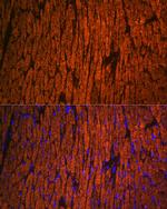 MYL2 Antibody in Immunohistochemistry (Paraffin) (IHC (P))