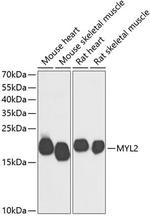 MYL2 Antibody in Western Blot (WB)