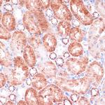 VASP Antibody in Immunohistochemistry (Paraffin) (IHC (P))