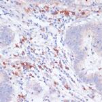 VASP Antibody in Immunohistochemistry (Paraffin) (IHC (P))