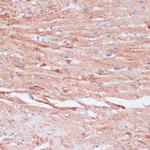 VASP Antibody in Immunohistochemistry (Paraffin) (IHC (P))