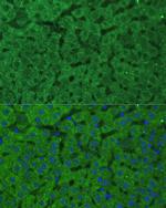 CBS Antibody in Immunohistochemistry (Paraffin) (IHC (P))