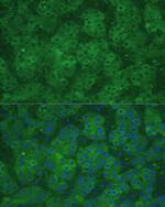 CBS Antibody in Immunohistochemistry (Paraffin) (IHC (P))