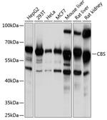 CBS Antibody in Western Blot (WB)