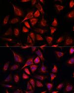 NDUFA4L2 Antibody in Immunocytochemistry (ICC/IF)