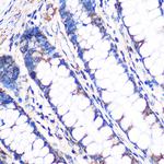 NDUFA4L2 Antibody in Immunohistochemistry (Paraffin) (IHC (P))