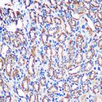 NDUFA4L2 Antibody in Immunohistochemistry (Paraffin) (IHC (P))