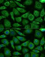 NDUFB3 Antibody in Immunocytochemistry (ICC/IF)