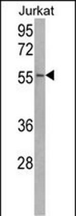 USP22 Antibody in Western Blot (WB)