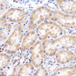 p38 MAPK alpha Antibody in Immunohistochemistry (Paraffin) (IHC (P))