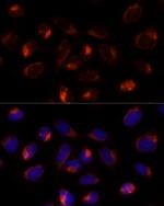 TXNDC12 Antibody in Immunocytochemistry (ICC/IF)