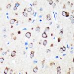 TXNDC12 Antibody in Immunohistochemistry (Paraffin) (IHC (P))