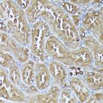 DLAT Antibody in Immunohistochemistry (Paraffin) (IHC (P))