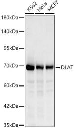 DLAT Antibody in Western Blot (WB)