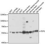 PDP1 Antibody in Western Blot (WB)