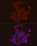 S100A10 Antibody in Immunocytochemistry (ICC/IF)