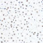 SP1 Antibody in Immunohistochemistry (Paraffin) (IHC (P))